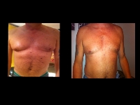 Image of Mens treatment